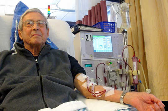 Why Older Adults On Dialysis Face Higher Risk For Dementia